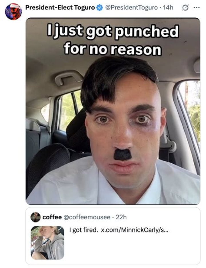 Glee’s Dianna Agron explains nose job: I got punched in the nose twice