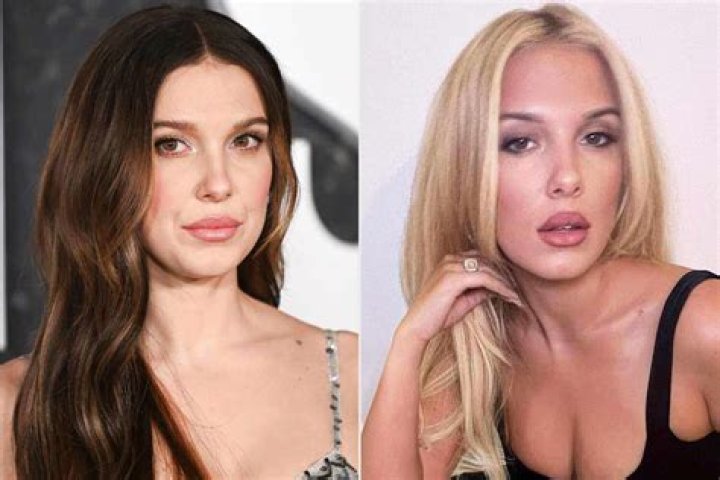 Millie Bobby Brown Plastic Surgery: Before And After Look